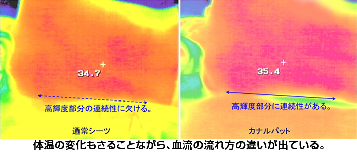 2026春限定｜寝ているだけで巡りが整い結果が変わる キャンペーン